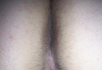 Mande's Hairy Yumyum