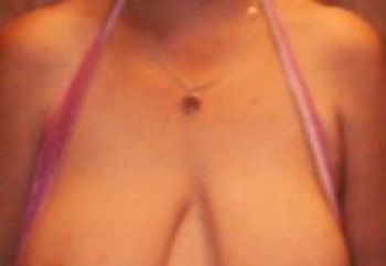 My Areolas 2