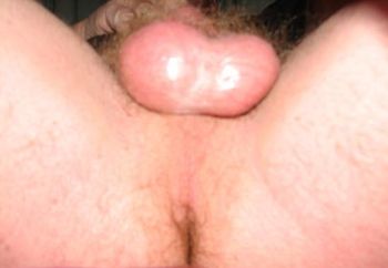 The view from below