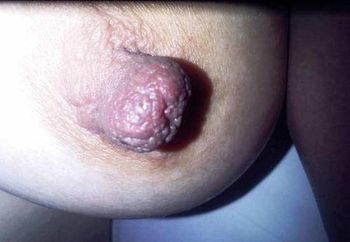  asian wf big nipples