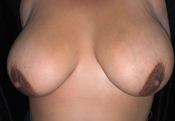 Big tits