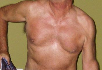 Artist's Model