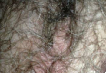 Some hairy pics