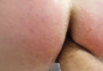 Spanked 