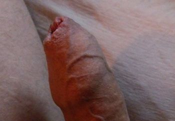 Lenstroyer selfies and dickpics