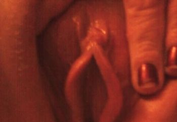 pussypic1