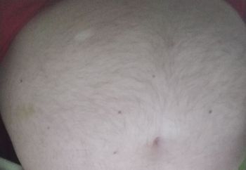 fat Body