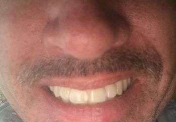 Sideways Smile. I gotta fix...